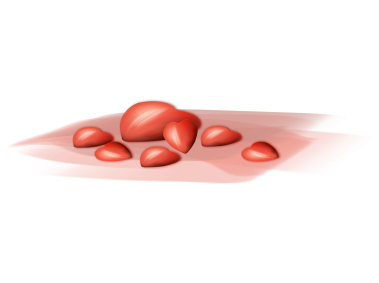Red Heart